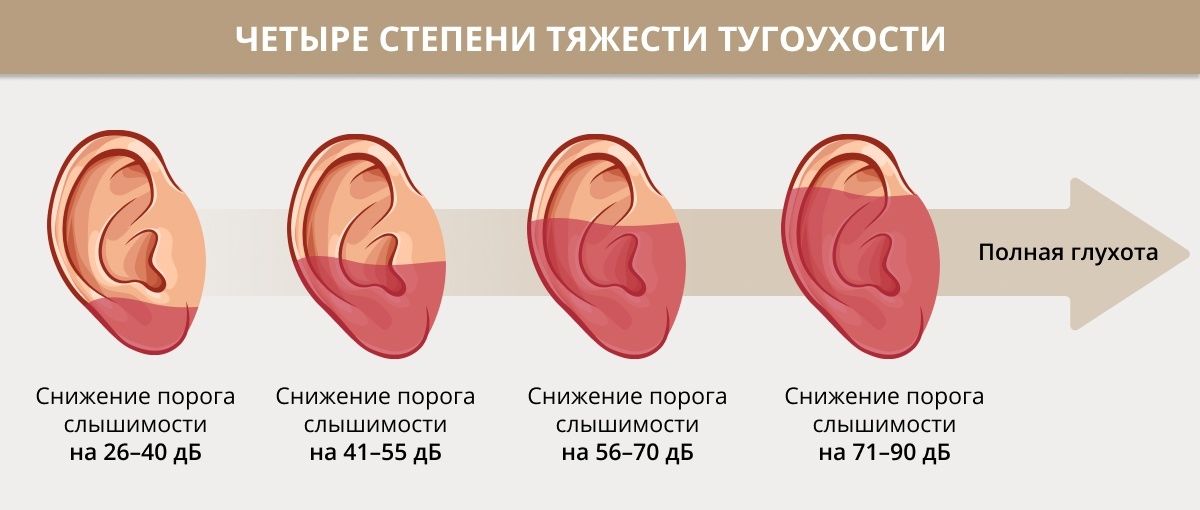1. Чему
2. снится
3. громкость
4. к